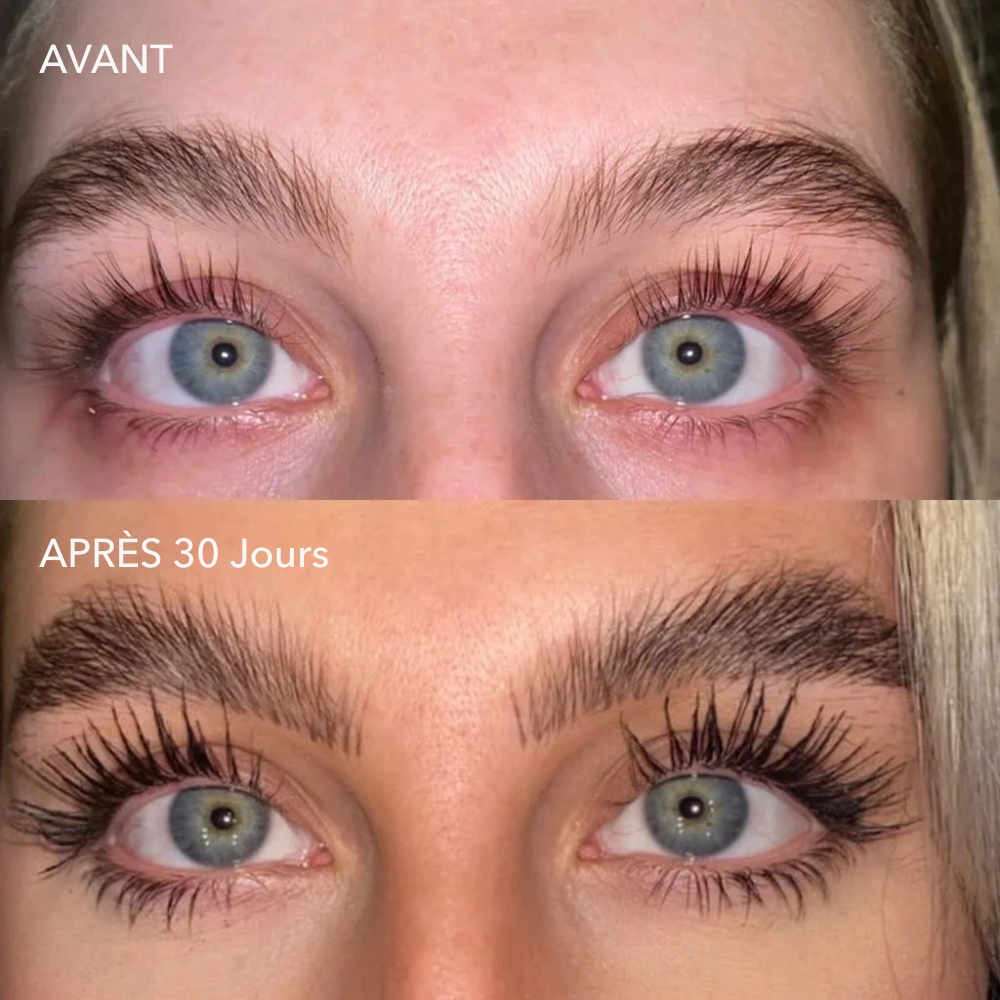 alluma. | Sérum de Croissance des Cils (1 Acheté = 1 OFFERT)