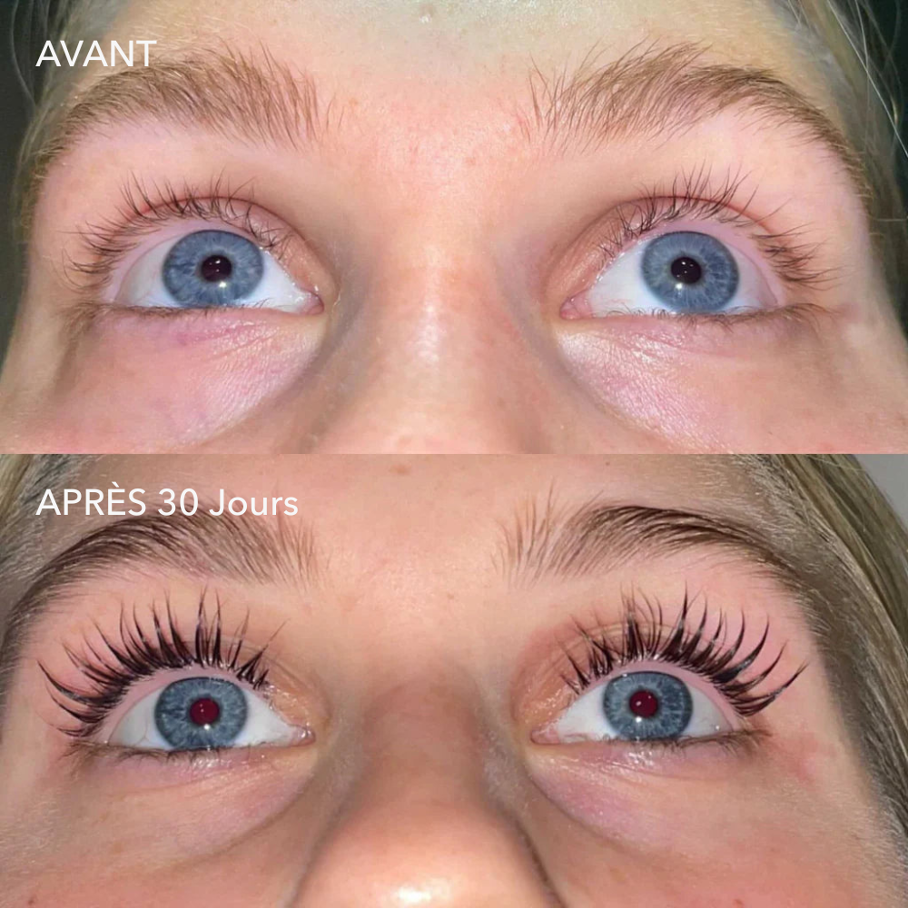 alluma. | Sérum de Croissance des Cils (1 Acheté = 1 OFFERT)