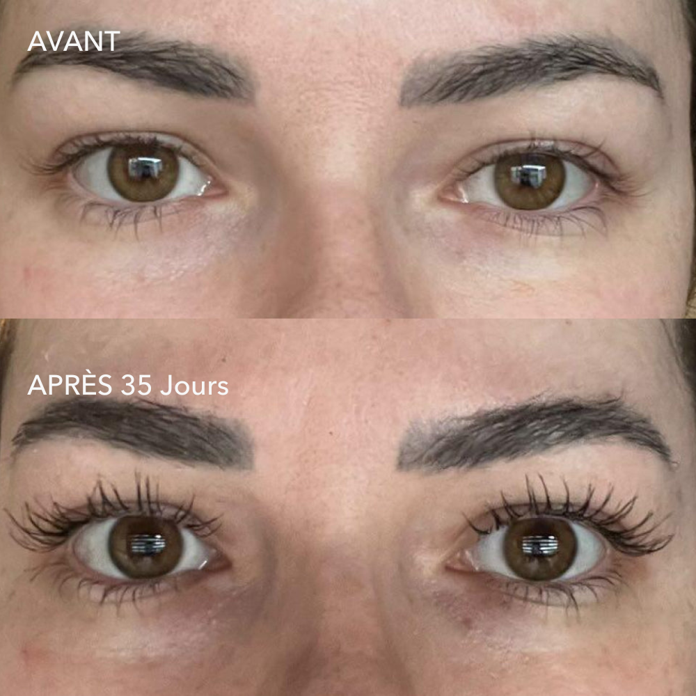 alluma. | Sérum de Croissance des Cils (1 Acheté = 1 OFFERT)