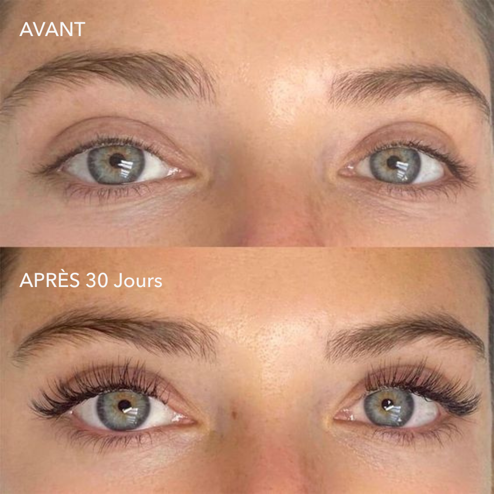 alluma. | Sérum de Croissance des Cils (1 Acheté = 1 OFFERT)
